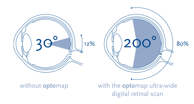 optomap retinal screening compared to traditional eye exam