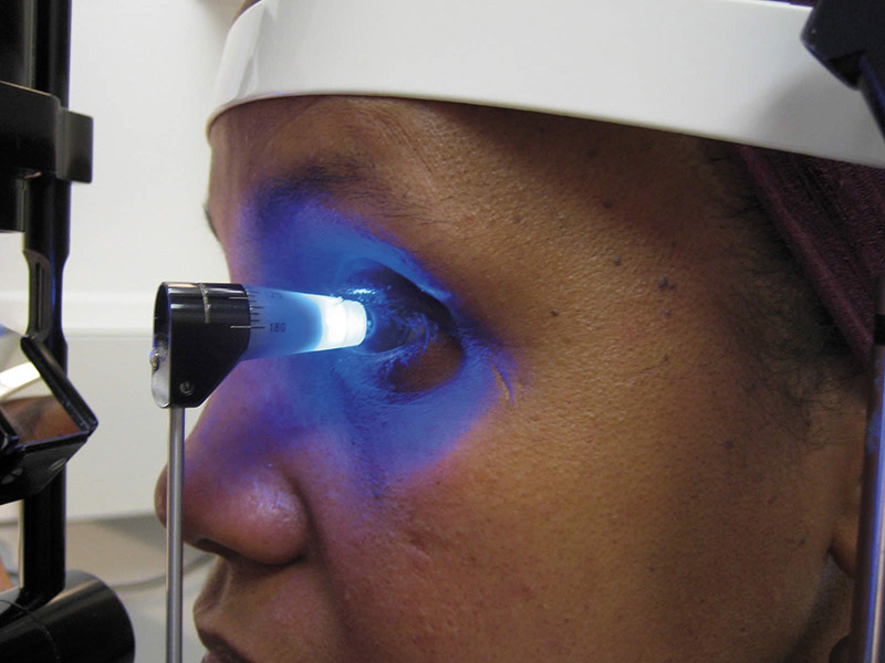 A person having their eyes tested for glaucoma.
