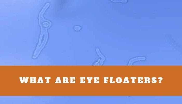 What Are Eye Floaters?