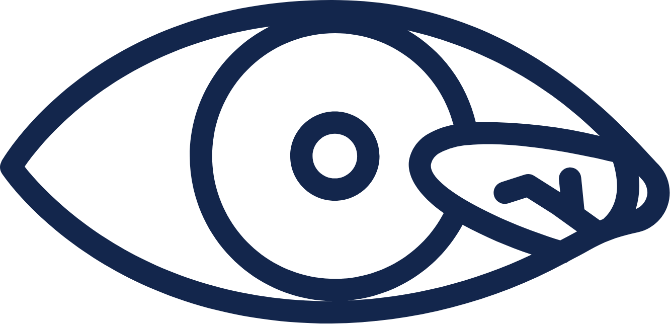 EyeInfections