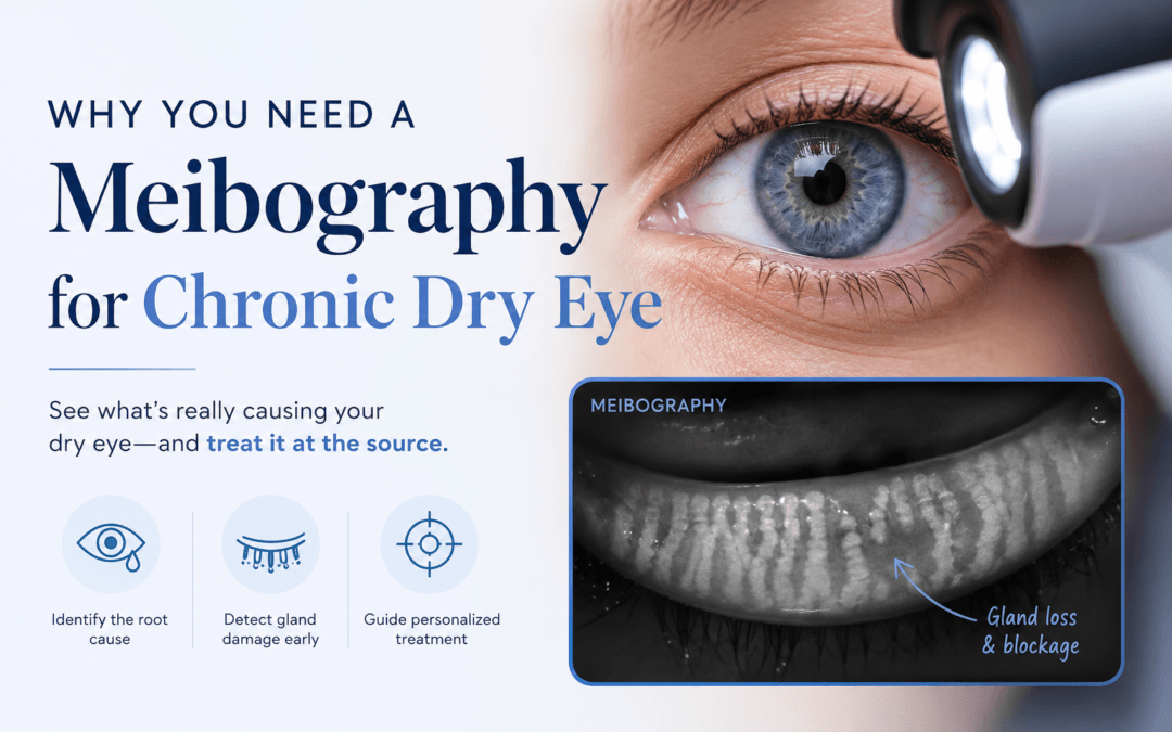 Why You Need a Meibography for Chronic Dry Eye
